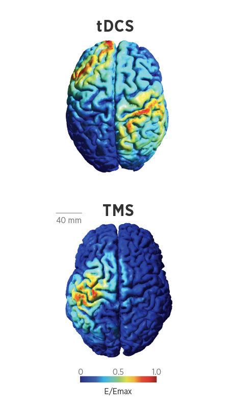 Spacial distribution on brain